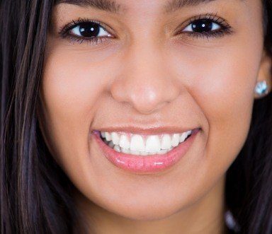 Woman with flawless smile after makeover