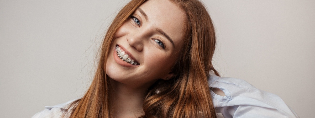 Young woman with Six Month Smiles clear braces smiling