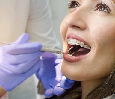 Dentist examining patient with six month smiles