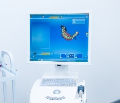 CEREC digital bite impressions on computer screen