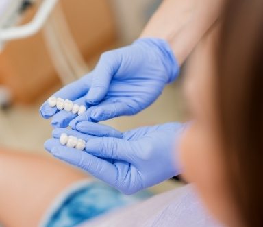 Dentist showing patient dental bridges