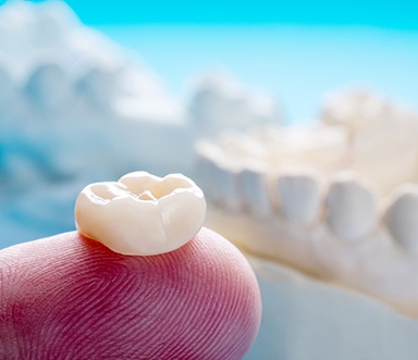 Understanding the many factors that affect the cost of dental crowns can make paying for it easier.