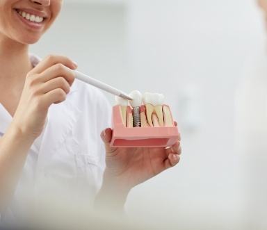 Dentist using smile model to explain advanced dental implant procedures