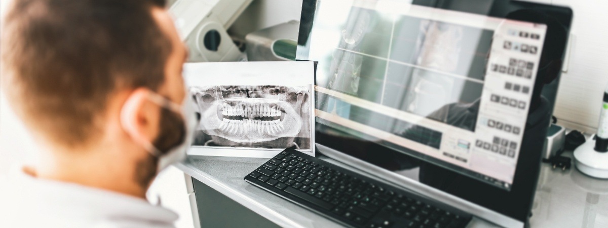 Dentist looking at multiple screens of digital x-rays