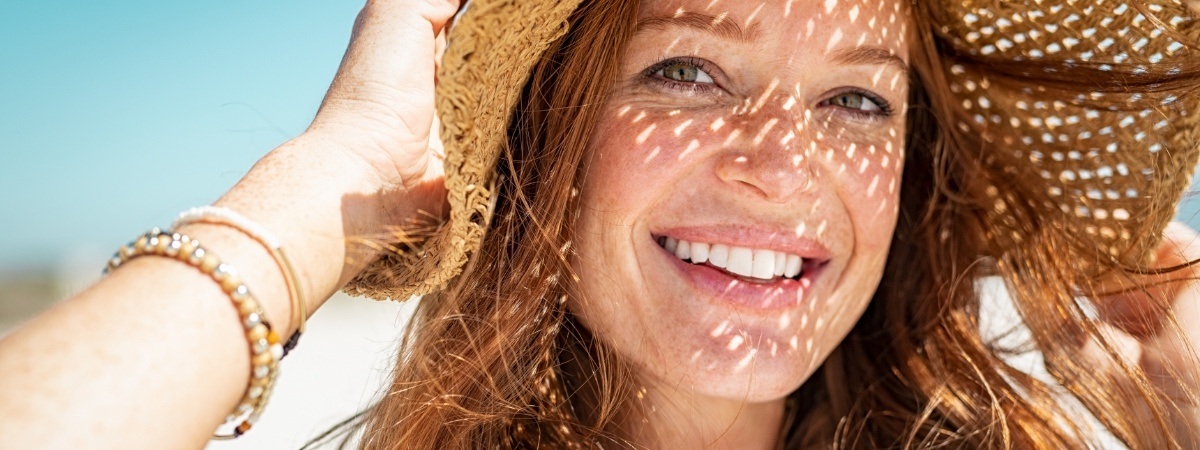 Woman's smile after porcelain veneers