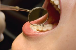 dentist in burlington provides regular care