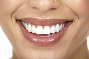 With porcelain veneers in Burlington, MA, patients at Complete Dental Care can have beautiful smiles in practically no time. 