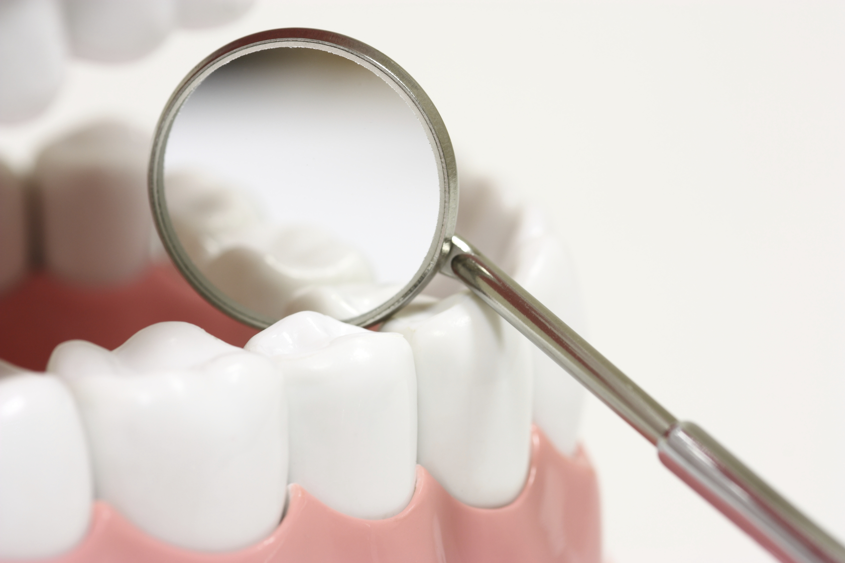 Dental Crowns from Your Dentist in Burlington MA